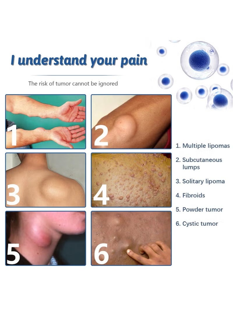 SOUTH MOON 3-PACK Lipoma Removal Spray, Lipoma Care Spray, Lump Free Spray, Lipoma Reduction, Anti-cellulite Body Shaper Spray for Men and Women, Lipoma Soothing Spray, 50ml*3 - Image 3