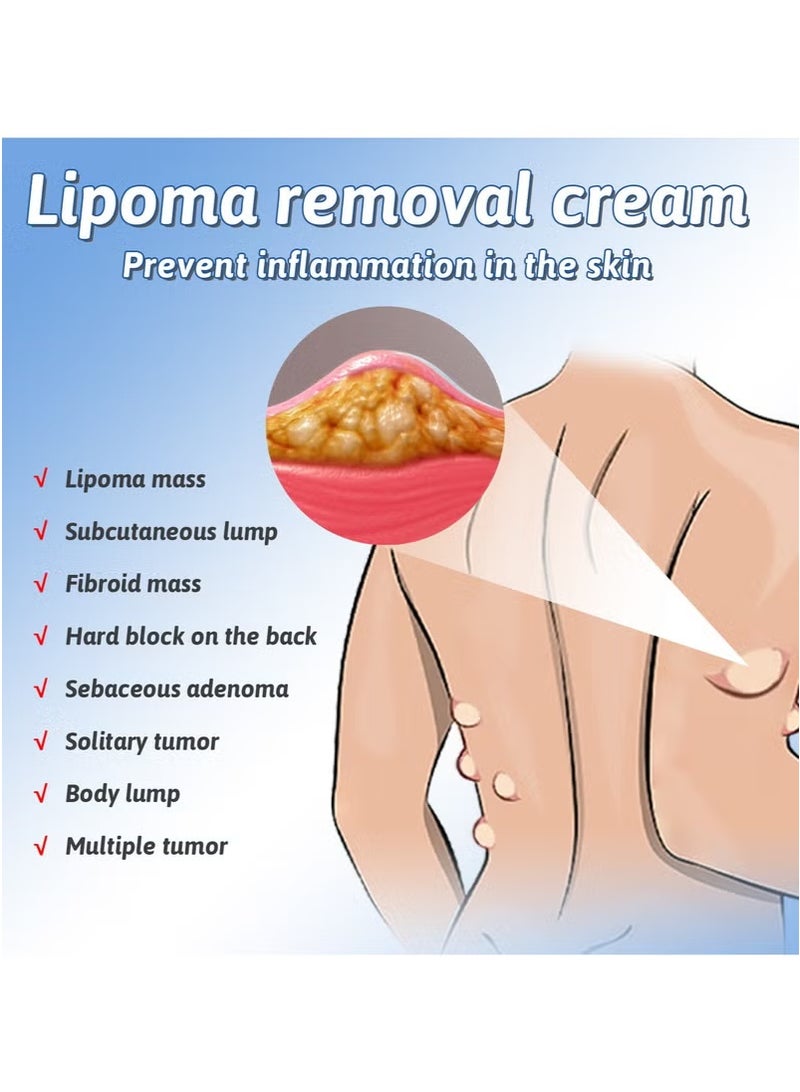 SOUTH MOON 3-PACK Lipoma Removal Spray, Lipoma Care Spray, Lump Free Spray, Lipoma Reduction, Anti-cellulite Body Shaper Spray for Men and Women, Lipoma Soothing Spray, 50ml*3 - Image 4