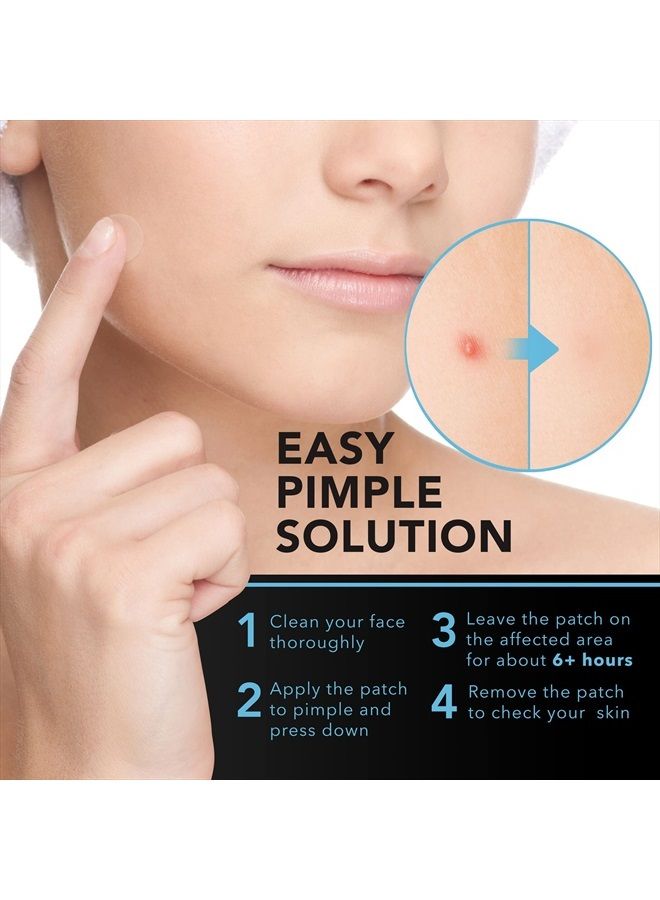 KEYCONCEPTS Acne Patches (120 Count) with Tea Tree Oil, Hydrocolloid Pimple Patches for Face - Zit Patch Acne Dots - Cystic Acne Patches - Pimple Patch with 3 Size Acne Stickers - Image 5