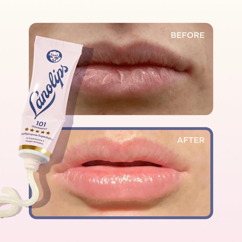 Lanolips 101 Ointment Multi-Balm Duo, Original Superbalm - Contains Pure Lanolin Oil for Smooth, Hydrated, & Healthy Lips - Natural Lip Balm for Dry Lips, Cuticles, & More (2-Pack, 0.52 oz each) - Image 5