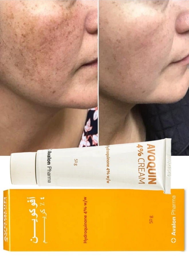 AVOQUIN Avalon AVOQUIN 4% Cream Lightening skin 50 gm  - Image 4