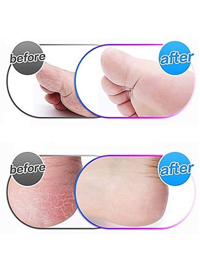 Jiumi 5 Pack Extra Coarse Replacement Rollers For Amope Pedi Refills Electronic Perfect Foot File Pedi Hard Skin Remover Refills Include a clean brush - Image 3