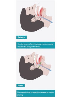 WANFAN Anti Snoring Devices 8PCS , Snore Stopper , Anti Snoring Nose Clip, Snoring Solution for Comfortable and Quieter Sleep, Stop Snoring  - Image 3