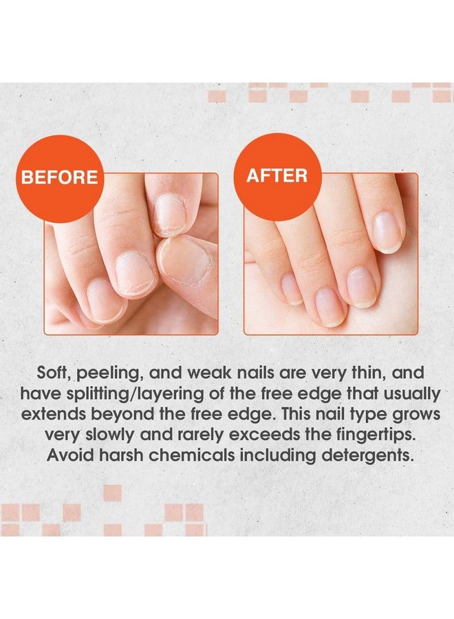 Nail Tek Intensive Therapy 2 Nail Strengthener For Soft And Peeling Nails 0.5 Oz X 2Pack - Image 4