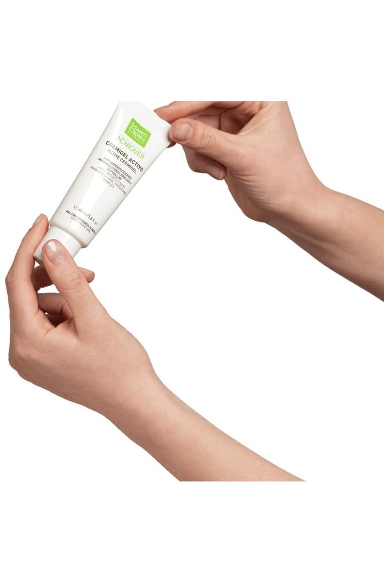 مارتيديرم أكنيوفر كريم جل فعال للبشرة الدهنية والمعرضة لحب الشباب 40 مل - Image 4