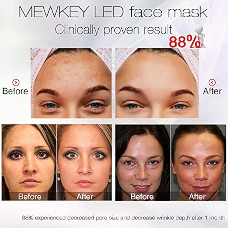 NEWKEY Blue light Therapy Mask for Face Acne, 7 Colors LED Acne Scar Spots Light Therapy Treatment with Silicone Eye Protector for Acne Prone Sensitive Skin and Blemishes Prevention,Plug-in - Image 2