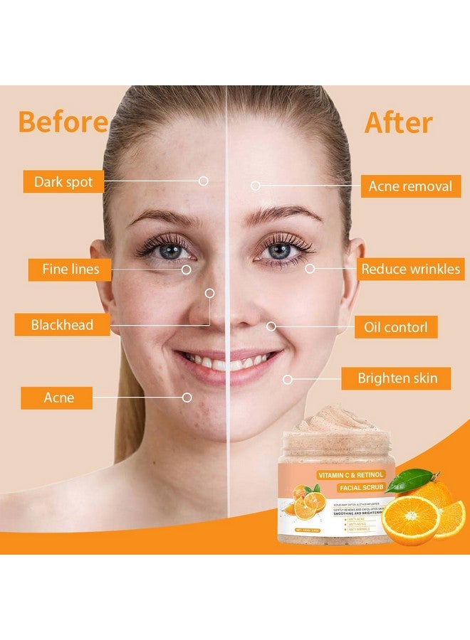 IREV Vitamin C Face Scrub, Exfoliating Facial Wash with Retinol, Face Scrub,Facial Exfoliating Scrub, Facial Scrubs for Women,Deep Cleansing Face Wash Cleanser for Women Men - Image 2