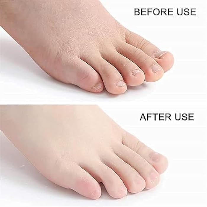 Your Feet Towel! Get Silky Soft Feet with Instant Exfoliating Spray.Eliminate Dry and Cracked Feet and Welcome Smooth Skin in Minutes.Pet- Generic - Image 2