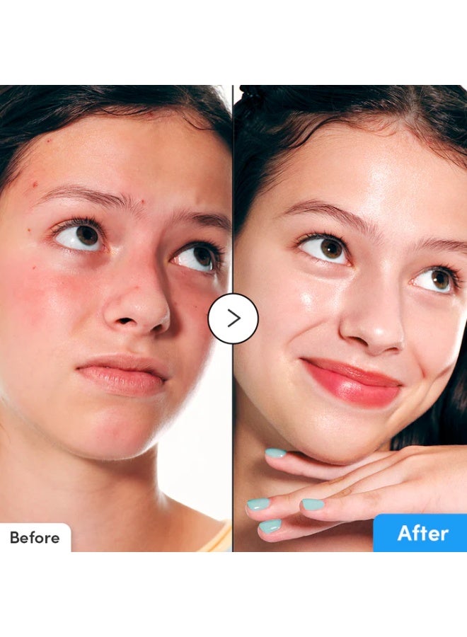 eqqualberry Hyaltoin Flooding Smoothie Serum 30ml, - Image 5