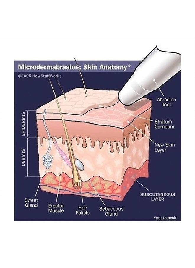 NeedCrystals - Microdermabrasion Crystals for Machines, All-Natural Facial Exfoliating Treatment for Dull or Dry Skin, Wrinkles, Blemishes, Scars & More (4 lb, 120 Grit) - Image 1