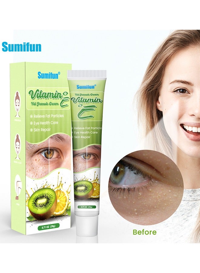 سوميفون علاج إزالة ميلليا الأساسي، علاج بقع الميلاليا يساعد على إذابة وتقليل الميلليا والرؤوس البيضاء وارتفاع الغدد الدهنية 20غ - Image 2