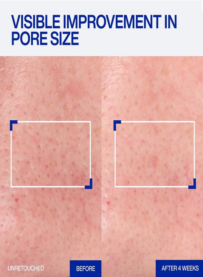 IOPE Expert Retinol RX 1% Super Bounce Serum - Gentle Anti-Aging Face Serum for Beginners - Visibly Firms Skin, Refines Pores, and Smooths Wrinkles - 1.01 fl. oz. - Image 3