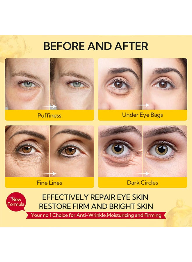 LANBENA Retinol Hydra-Gel Eye Patches, Gold Under Eye Mask Retinol And Collagen, Under Eye Mask For Face Care, Eye Masks For Dark Circles And Puffiness, Under Eye Masks For Beauty And  Personal Care 30 Pairs - Image 5