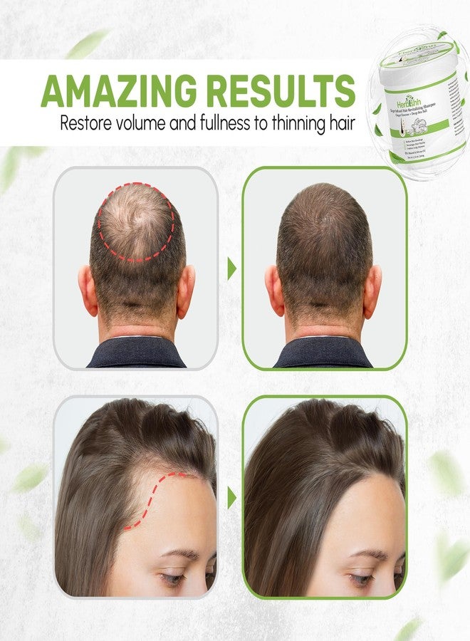 Herbishh Ginger Hair Revitalizing Shampoo Jar with Deep Sea Salt - Anti Dandruff Shampoo for Weak, Brittle Hair & Dry Scalp - Boosts Hair Growth & Free from Mineral & Silicon Oil, 17.6 oz - Image 2