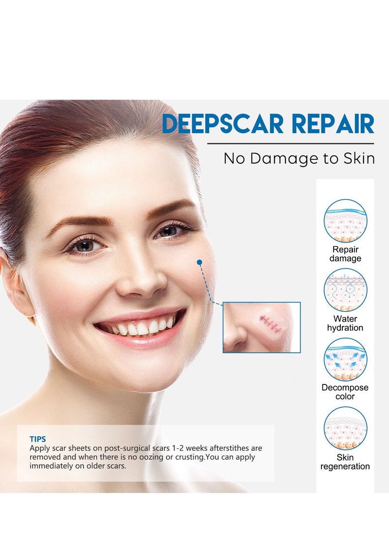 Elaimei Facial Invisible Scar Roll Sticker Self-Adhesive Waterproof Breathable Ultra-Thin Scald Scar Surgery Scar Silicone  - Image 5