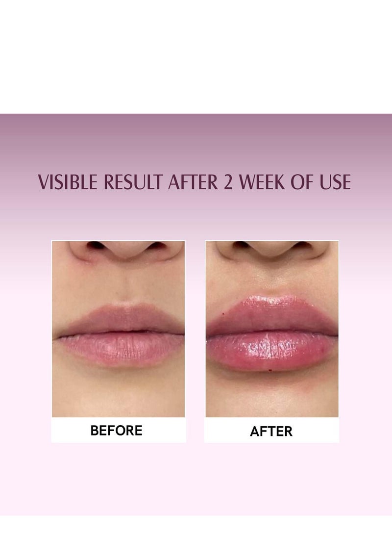Beetroot Lip Scrub With Beetroots, Shea er  Cocoa er - For Dark,Chapped  mented Lips - For Brightening Dark Lips - For Men and Women - 15 gm - Image 5