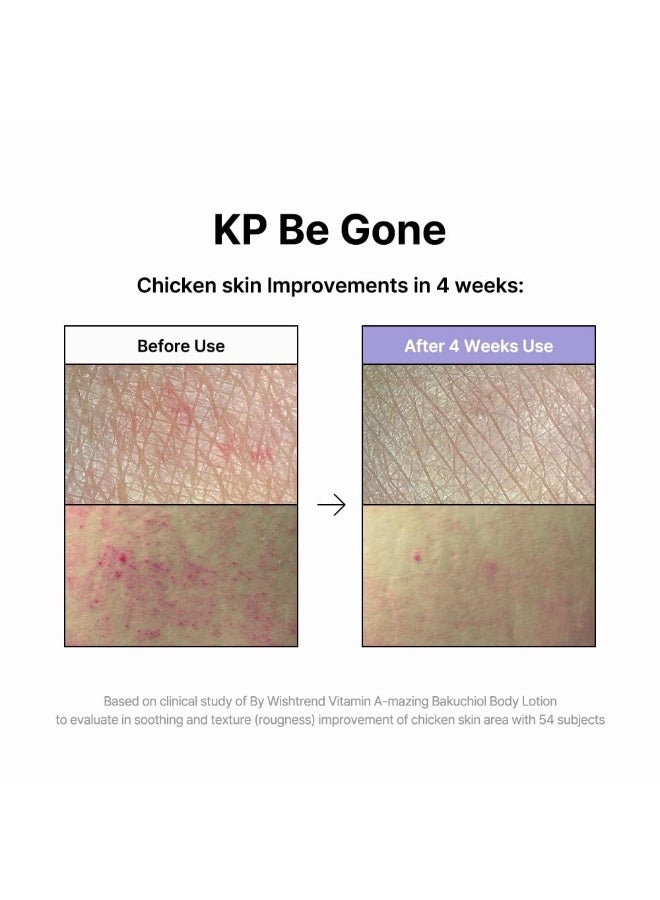 By Wishtrend Vitamin A-mazing Bakuchiol Body Lotion 150g, Korean body lotion, skin bumps, chicken skin, hyperpigmentation, dull wrinkles, pore care for All Skin Ty - Image 5