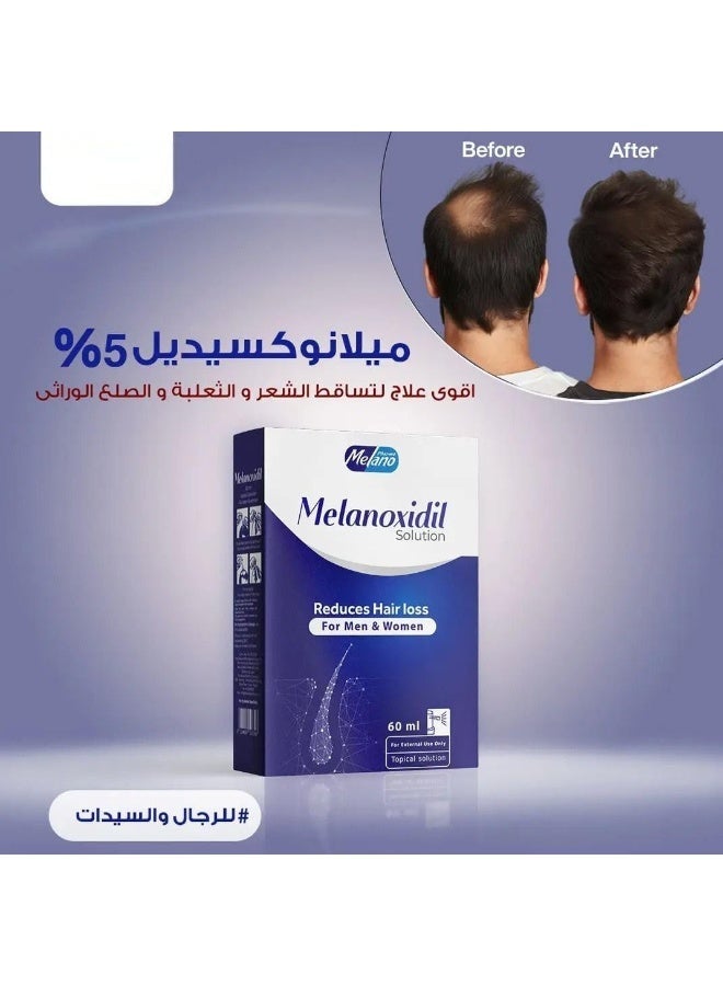 محلول بخاخ موضعي 5% لعلاج تساقط الشعر للرجال والنساء ، ٦٠ مل - Image 4