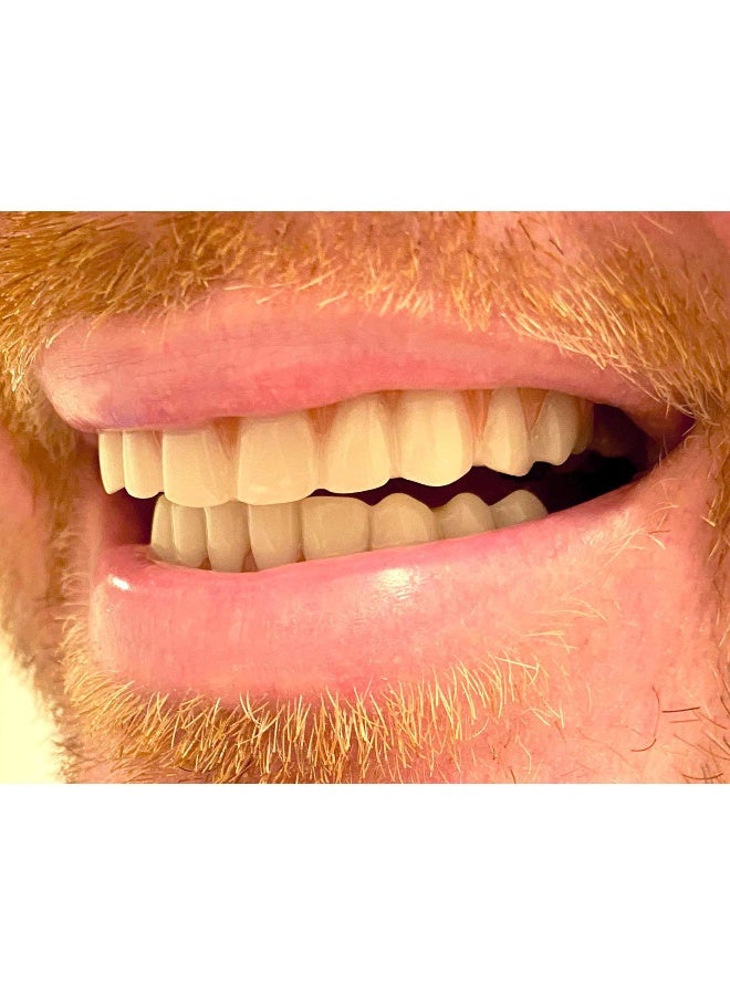 Instant Smile Comfort Fit Flex Teeth Upper and Lower Matching Set Natural Shade Fix Your Smile at Home Within Minutes - Image 3