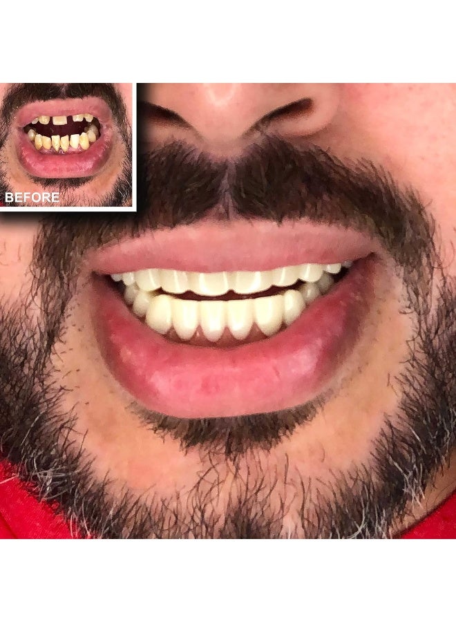 Instant Smile Comfort Fit Flex Teeth Upper and Lower Matching Set Natural Shade Fix Your Smile at Home Within Minutes - Image 5