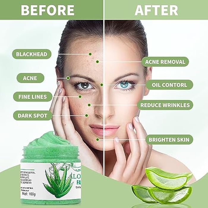 IREV Aloe Vera Facial Scrub & Cleanser - Exfoliating Face Wash for Blackheads & Acne - Image 2