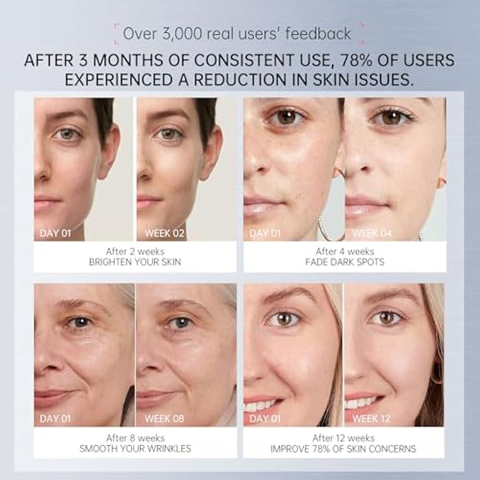 VGO مجموعة العناية بالبشرة المضادة للشيخوخة VGO – سيروم فيتامين C و الريتينول للوجه مع حمض الهيالورونيك، النياسيناميد، والريتينول لمكافحة التجاعيد والت firming 1.56 أونصة - Image 3