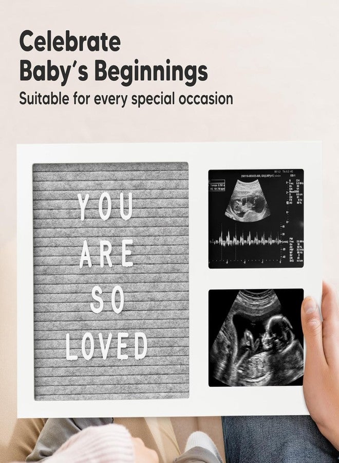 a baby cherry إطار صور للأطفال الرضع - إطار صور للأطفال مع لوحة من اللباد وحروف بارزة | صورة عامي الأول | إطار صور الموجات فوق الصوتية | أبيض - Image 5