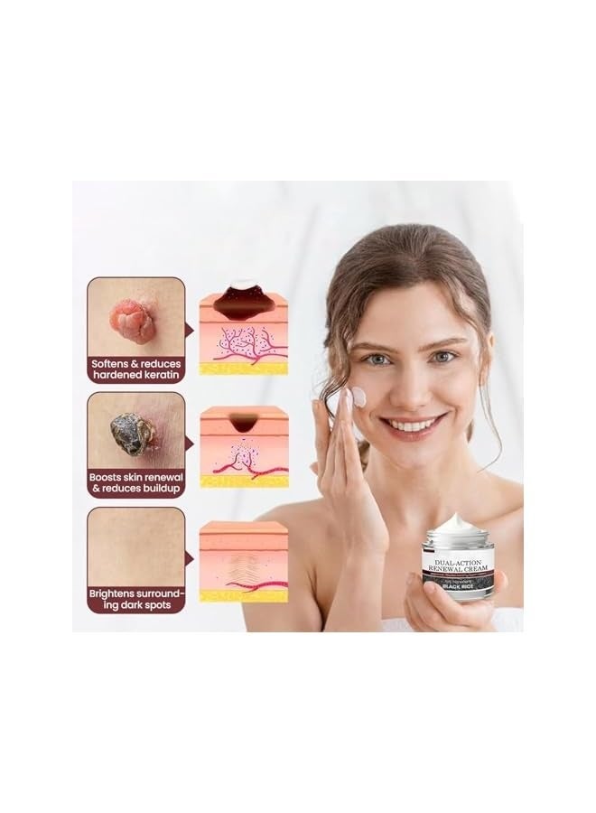 DUAL-ACTION PLANT WART REMOVAL CREAM, Dual-Action Renewal Cream, Black and White Rice Soothing Repair cream, Professional Skin Treatment, Smooths And Refines The Skin, Natural Body Serum Suitable for All Skin Types (50g) - Image 2