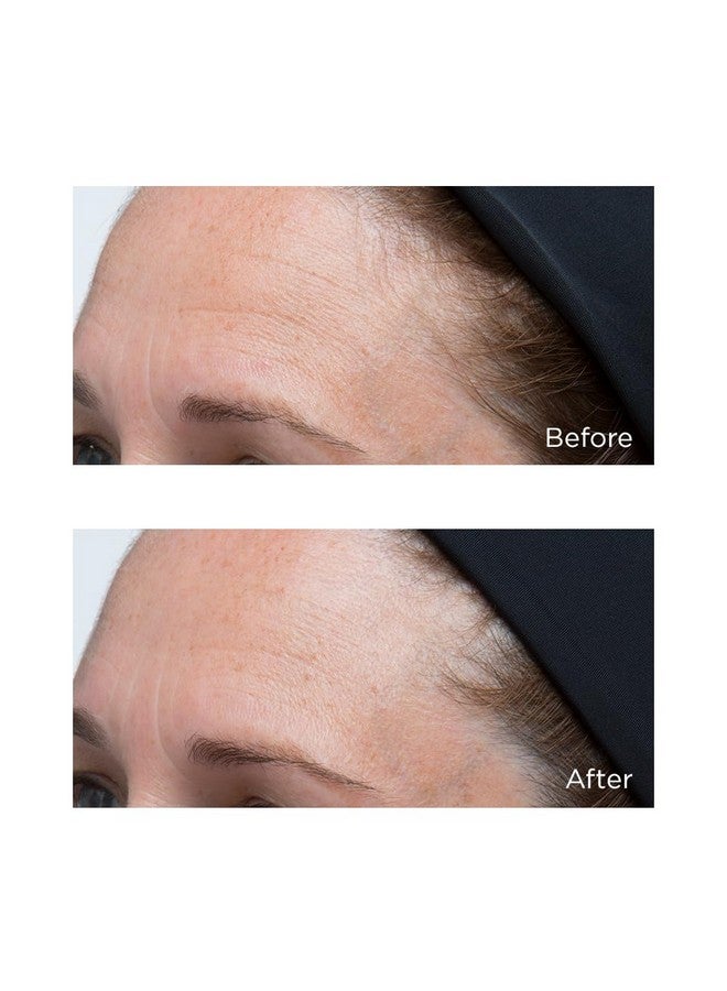 Perricone MD High Potency Classics: Hyaluronic Intensive Moisturizer 1 Fl Oz (Pack Of 1) - Image 5