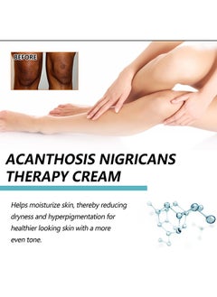 EELHOE Acanthosis Nigricans Therapy Cream- with Lactic Acid ,Dermatologist Tested Retinol Cream , Hyperpigmentation Removal Cream , For Dark Body Parts like Neck Ankles Knuckles Armpits 50g  - Image 4