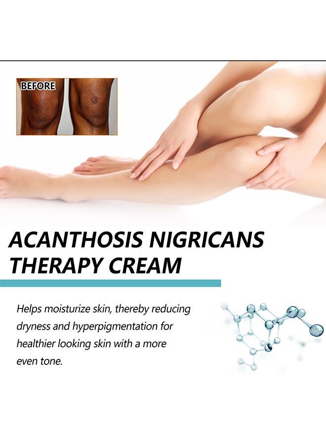 EELHOE - Acanthosis Nigricans Therapy Cream- with Lactic Acid ,Dermatologist Tested Retinol Cream , Hyperpigmentation Removal Cream , For Dark Body Parts like Neck Ankles Knuckles Armpits 50g - Image 1