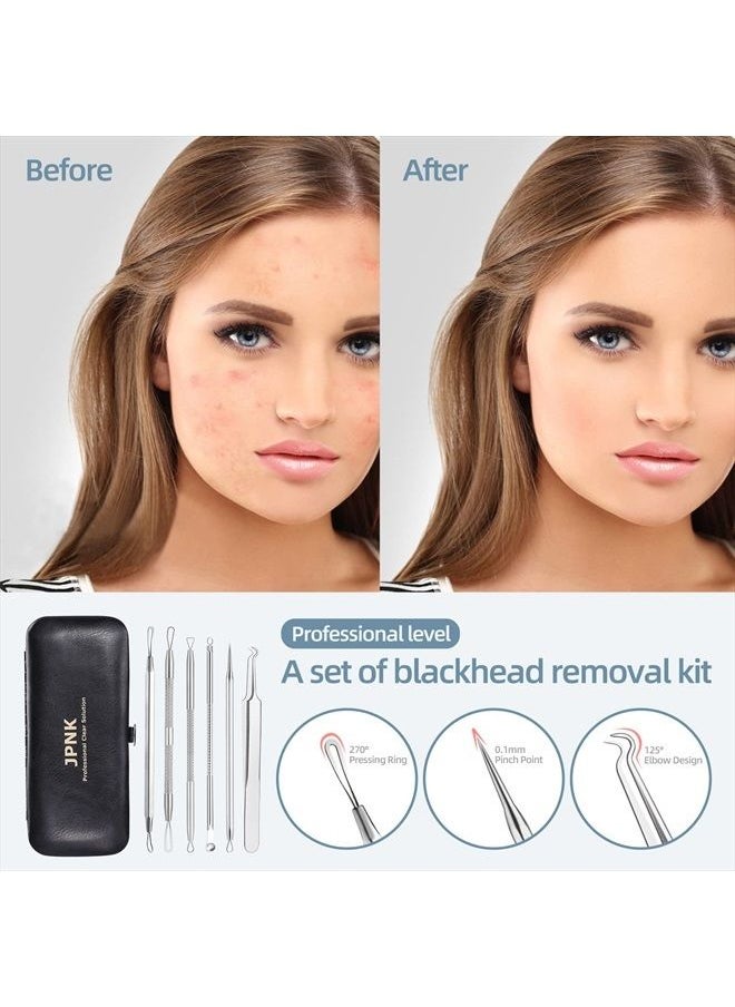 JPNK - Blackhead Remover Tool Comedones Extractor Acne Removal Kit for Blemish, Whitehead Popping, 6 Pcs Zit Removing for Nose Face Tools with a Leather Bag - Image 1