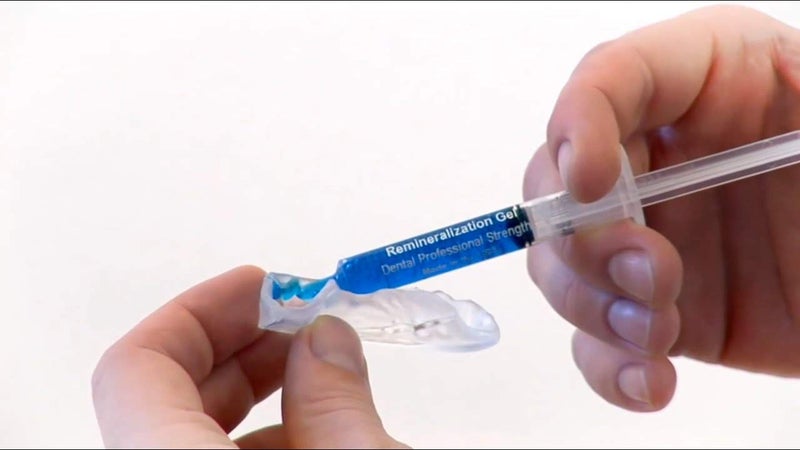 Sparkling White Smiles 4 Syringes Remineralization Gel with 4 Custom Teeth Trays - Strengthens Enamel - Reduces Sensitivity - Remineralizes and Desensitizes - Great for After Teeth Whitening - Image 1