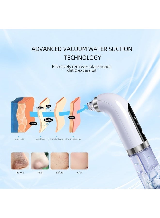 Blackhead Remover Pore Vacuum Cleaner Electric Micro Small Bubble Facial Cleasing Machine USB Rechargeable Beauty Device - Image 2