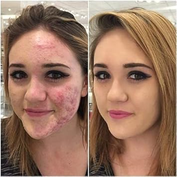 Glamza PHOERA Foundation Concealer Makeup Full Coverage Matte Brighten Long Lasting UK 101 PORCELAIN - Image 2
