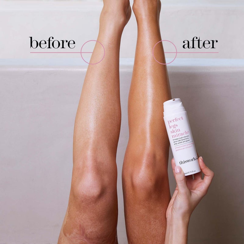 THISWORKS Perfect Legs Skin Miracle: Tinted Serum with Vitamin C & E for Radiant, Sun-Kissed Glow, Evens Skin Tone & Reduces Imperfections, 5 fl ozâ€‹ - Image 2