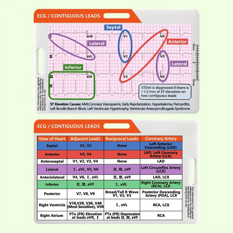 بطاقة تحليل تخطيط القلب الملون (ECG/EKG) لحالات STEMI - طباعة أمامية وخلفية - تصميم أفقي ورأسي - مادة أكريليك - نص باللغة الإنجليزية - مرجع سريع للتفسير - للمهنيين الطبيين - أداة تعليمية للحوادث القلبية - Image 1