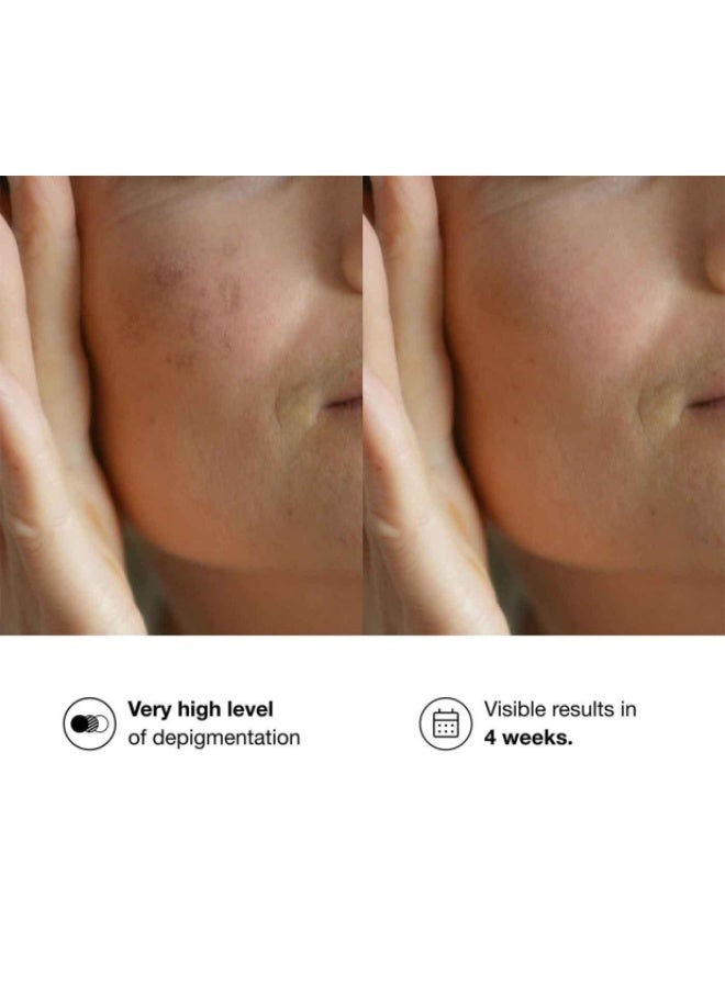 Bella Aurora Bio10 Forte M-lasma Depigmenting Treatment 30ml - Image 4