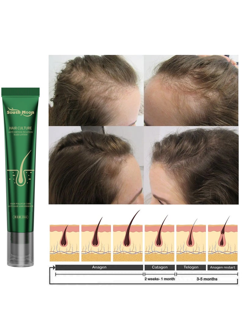 SOUTH MOON - Ginger Hair Oils, Pure Organic Ginger Hair Growth Serum, Moisturize, Repair Thin Root, Restore Follicles Essence, Suitable for Hair Growth, Dry Damaged Hair, Hair Loss Scalp Treatment 20ml - Image 1