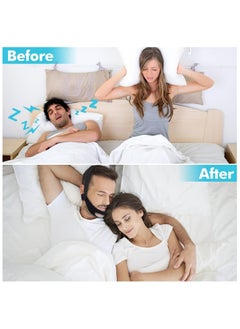 RATSAW Anti Snoring Chin Strap, Upgrade Anti Snoring Devices, Anti Snoring Devices Anti Snoring Chin Strap for Men Women,Chin Straps Sleep Aids for Snoring Mouth Breather Mouth Closed While Sleeping  - Image 5