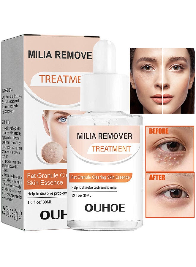 OUHOE Milia Removal Treatment, Milia Spot Treatment Helps Dissolve And Reduce Milia, Whitehead And Sebaceous Hyperplasia, Cysts And Sebaceous Hyperplasia Face Serum 30 ML - Image 1