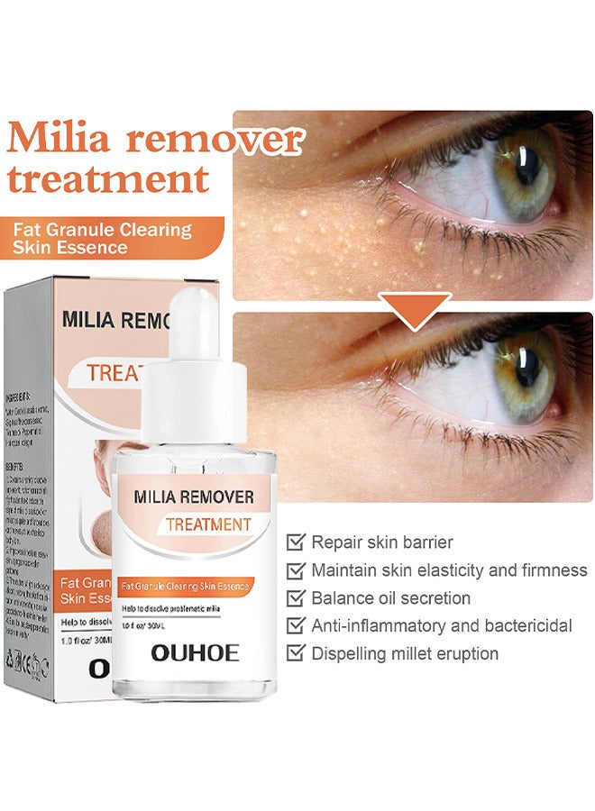 OUHOE Milia Removal Treatment, Milia Spot Treatment Helps Dissolve And Reduce Milia, Whitehead And Sebaceous Hyperplasia, Cysts And Sebaceous Hyperplasia Face Serum 30 ML - Image 4