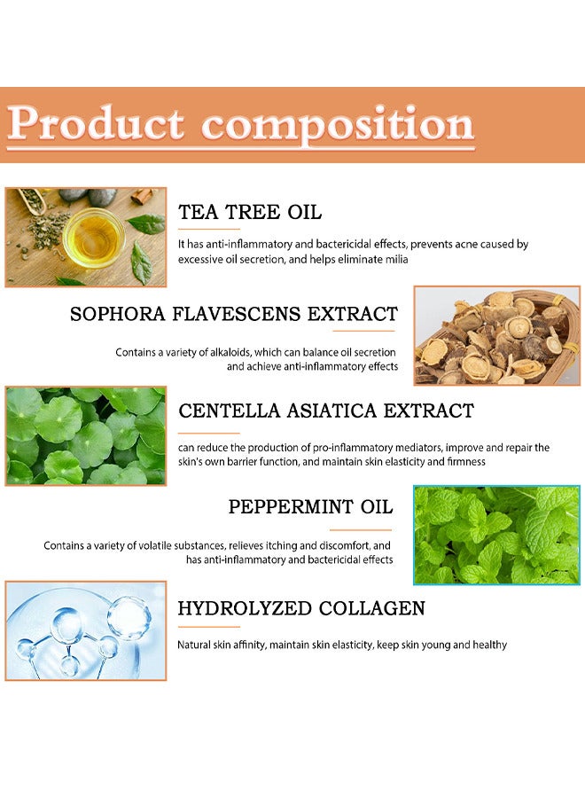 OUHOE Milia Removal Treatment, Milia Spot Treatment Helps Dissolve And Reduce Milia, Whitehead And Sebaceous Hyperplasia, Cysts And Sebaceous Hyperplasia Face Serum 30 ML - Image 3