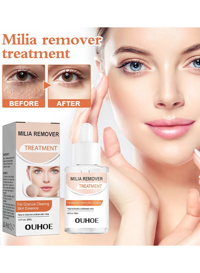 OUHOE Milia Removal Treatment, Milia Spot Treatment Helps Dissolve And Reduce Milia, Whitehead And Sebaceous Hyperplasia, Cysts And Sebaceous Hyperplasia Face Serum 30 ML - Image 2