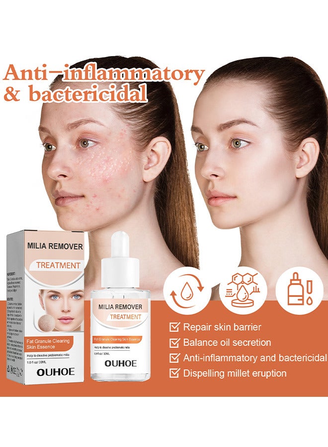 OUHOE Milia Removal Treatment, Milia Spot Treatment Helps Dissolve And Reduce Milia, Whitehead And Sebaceous Hyperplasia, Cysts And Sebaceous Hyperplasia Face Serum 30 ML - Image 5