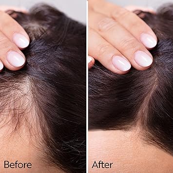 ahuhu ESSENTIAL ANTIAGE Elixir with Redensyl Caffeine 100ml Highly effective scalp care for thicker hair Stimulates hair growth Vegan - Image 3