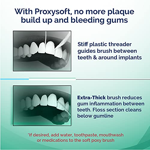 ProxySoft Periodontal Floss, 2 Packs - Dental Floss Threader, Braces Floss and Thick ProxyBrush for Daily Care of Periodontal Disease and Gum Health - Orthodontic Flossers for Braces and Teeth - Image 3