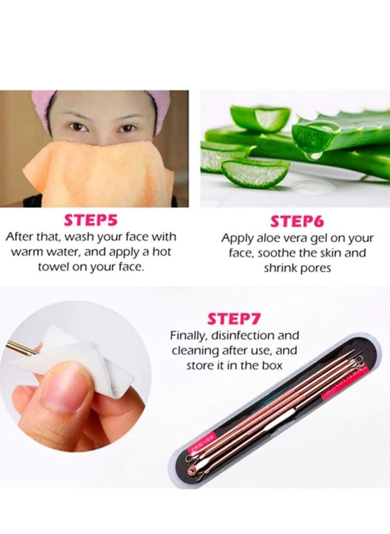 SYOSI Stainless Steel 4pc Comedone Blackhead Remover Facial Skin Care Pimple Acne Blemish Extractors Pimple Comedone Extractor Popper Tools Set  - Image 4
