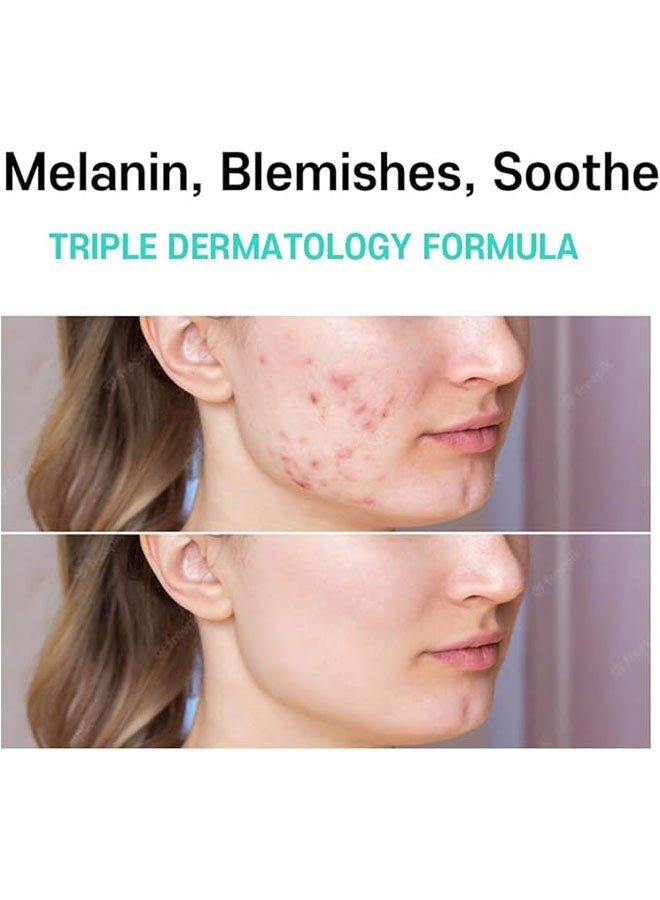 CARENEL Anti Melasma Cica Cream, Melasma Treatment for Face Cream, Dark Spot Remover Centella Asiatica, Skin Care Beauty Products - Image 2