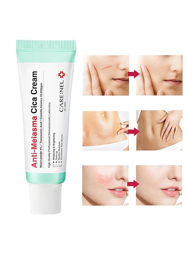 CARENEL Anti Melasma Cica Cream, Melasma Treatment for Face Cream, Dark Spot Remover Centella Asiatica, Skin Care Beauty Products - Image 5